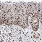 Immunohistochemical staining of human skin shows strong nuclear positivity in squamous epithelial cells.