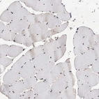 Immunohistochemical staining of human skeletal muscle shows no nuclear positivity in striated muscle fibers as expected.