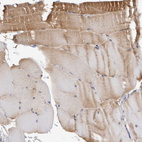 Immunohistochemical staining of human skeletal muscle shows moderate cytoplasmic positivity in myocytes.