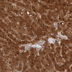 Anti-PGM1 Antibody