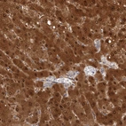 Immunohistochemical staining of human liver shows strong cytoplasmic positivity in hepatocytes.