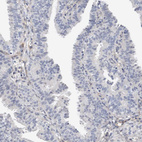 Anti-PGM1 Antibody