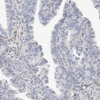 Immunohistochemical staining of human fallopian tube shows no cytoplasmic positivity in glandular cells as expected.