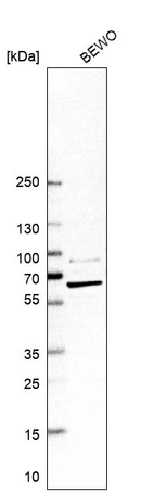 Western blot analysis in human cell line BEWO.