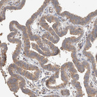 Immunohistochemical staining of human Fallopian tube shows moderate cytoplasmic positivity in glandular cells.