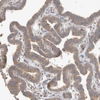 Immunohistochemical staining of human Fallopian tube shows moderate cytoplasmic positivity in glandular cells.