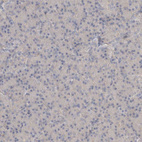 Immunohistochemical staining of human pancreas shows no cytoplasmic positivity in exocrine glandular cells as expected.