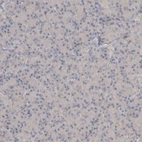 Immunohistochemical staining of human pancreas shows no cytoplasmic positivity in exocrine glandular cells as expected.