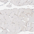 Immunohistochemical staining of human skeletal muscle shows no cytoplasmic positivity in myocytes as expected.
