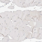 Immunohistochemical staining of human skeletal muscle shows no cytoplasmic positivity in myocytes as expected.