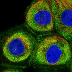 Immunofluorescent staining of human cell line A-431 shows localization to plasma membrane, cytosol & cell junctions.