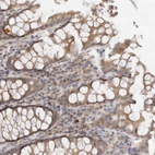 Immunohistochemical staining of human rectum shows moderate cytoplasmic positivity in glandular cells.