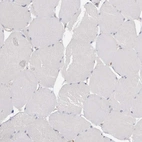Immunohistochemical staining of human skeletal muscle shows negative cytoplasmic positivity in myocytes as expected.