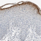 Immunohistochemical staining of human skin shows high expression.