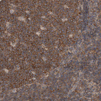 Anti-DDX6 Antibody