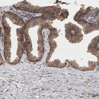 Immunohistochemical staining of human prostate shows moderate cytoplasmic positivity in glandular cells.