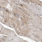 Immunohistochemical staining of human skeletal muscle shows weak cytoplasmic positivity in myocytes.