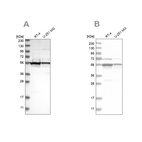 Anti-DDX6 Antibody