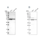 Western blot analysis using Anti-DDX6 antibody HPA024201 (A) shows similar pattern to independent antibody HPA026644 (B).