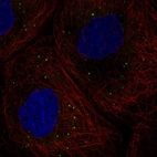 Immunofluorescent staining of human cell line A-431 shows localization to cytoplasmic bodies.