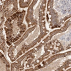 Anti-TRIM41 Antibody
