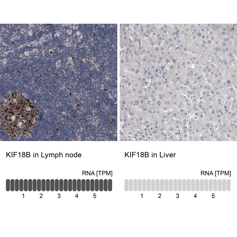 Anti-KIF18B Antibody