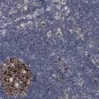 Immunohistochemical staining of human lymph node shows strong nuclear positivity in germinal center cells.