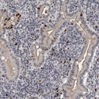 Anti-KIF18B Antibody