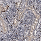 Immunohistochemical staining of human duodenum shows strong nuclear positivity in a subset of lymphoid cells.