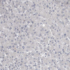 Immunohistochemical staining of human liver shows no positivity in hepatocytes as expected.