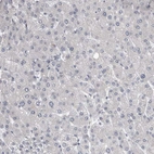 Immunohistochemical staining of human liver shows no positivity in hepatocytes as expected.