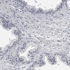 Immunohistochemical staining of human prostate shows no positivity in glandular cells as expected.