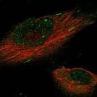 Immunofluorescent staining of human cell line U-251 MG shows localization to nucleus, cytosol & microtubule ends.