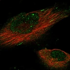 Immunofluorescent staining of human cell line U-251 MG shows localization to nucleus, cytosol & microtubule ends.