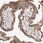Immunohistochemical staining of human placenta shows strong nuclear positivity in trophoblastic cells.