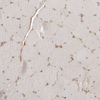 Immunohistochemical staining of human skeletal muscle shows moderate nuclear positivity in myocytes.