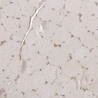 Immunohistochemical staining of human skeletal muscle shows moderate nuclear positivity in myocytes.