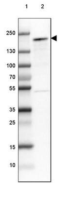 Lane 1: Marker [kDa] 250, 130, 100, 70, 55, 35, 25, 15, 10_br/_Lane 2: Human cell line MCF-7