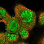 Immunofluorescent staining of human cell line A-431 shows localization to nucleoplasm & cytosol.