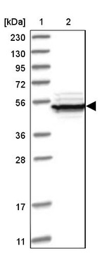 Lane 1: Marker [kDa] 230, 130, 95, 72, 56, 36, 28, 17, 11_br/_Lane 2: Human cell line RT-4