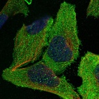 Immunofluorescent staining of human cell line U-2 OS shows localization to plasma membrane & cytosol.