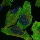 Immunofluorescent staining of human cell line U-2 OS shows localization to plasma membrane & cytosol.