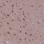 Anti-KIAA1107 Antibody