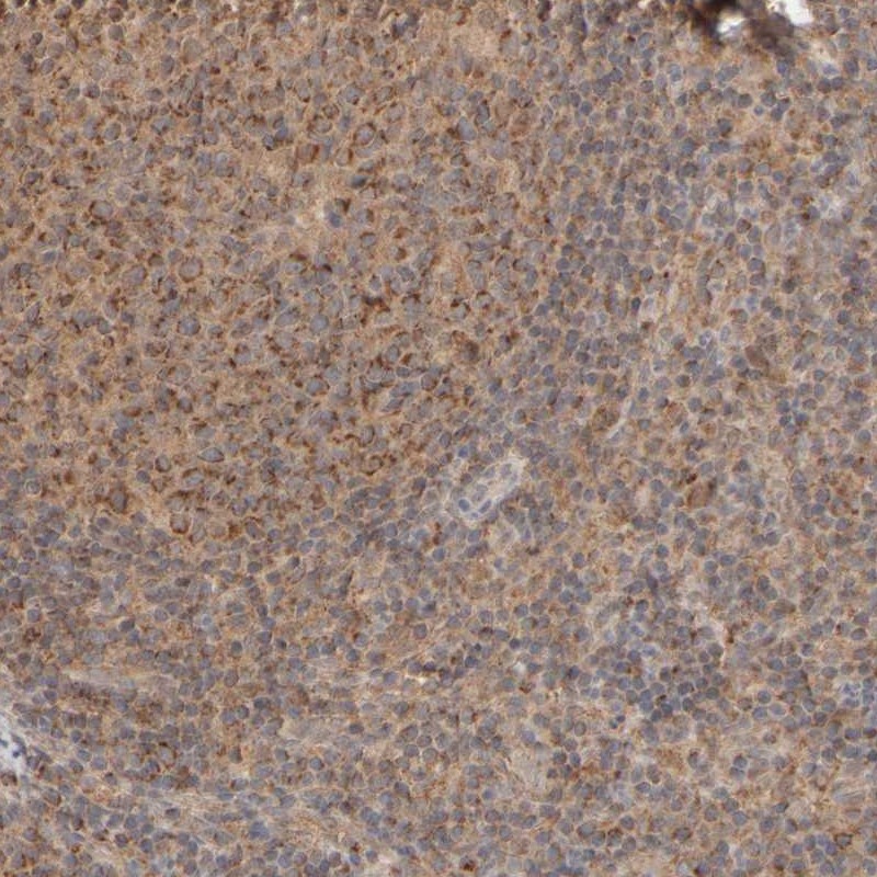 Anti-EIF2B3 Antibody