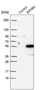 Western blot analysis in control (vector only transfected HEK293T lysate) and EIF2B3 over-expression lysate (Co-expressed with a C-terminal myc-DDK tag (~3.1 kDa) in mammalian HEK293T cells, LY433030).
