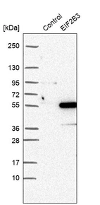 Western blot analysis in control (vector only transfected HEK293T lysate) and EIF2B3 over-expression lysate (Co-expressed with a C-terminal myc-DDK tag (~3.1 kDa) in mammalian HEK293T cells, LY433030).