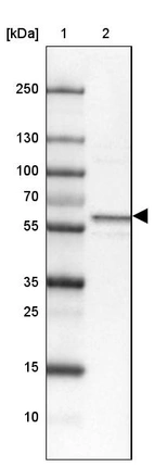 Lane 1: Marker [kDa] 250, 130, 100, 70, 55, 35, 25, 15, 10_br/_Lane 2: Human Tonsil tissue