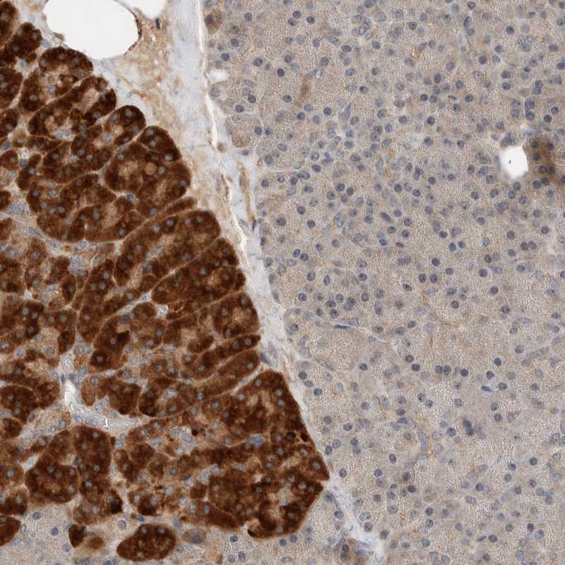 Anti-ARMC7 Antibody