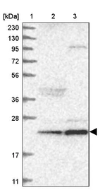 Lane 1: Marker [kDa] 230, 130, 95, 72, 56, 36, 28, 17, 11_br/_Lane 2: Human cell line RT-4_br/_Lane 3: Human cell line U-251MG sp
