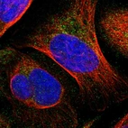 Immunofluorescent staining of human cell line U-2 OS shows localization to cytosol.
